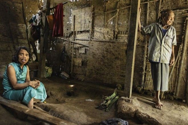 Низшая форма жизни ужасающие условия индонезийских лечебниц для душевнобольных