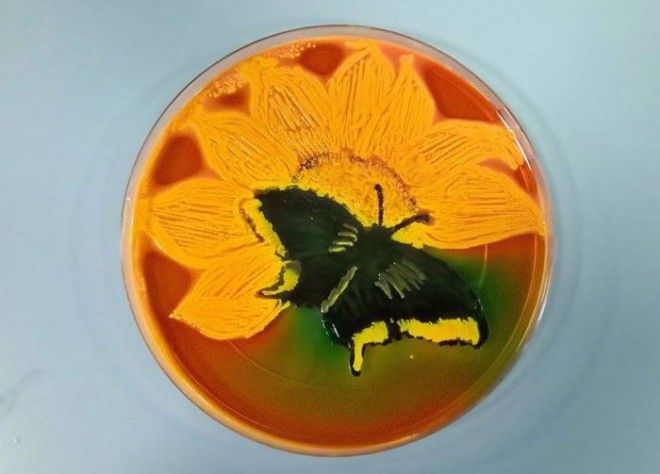 Цветение Shigella Salmonella бактерия картина микробиолог