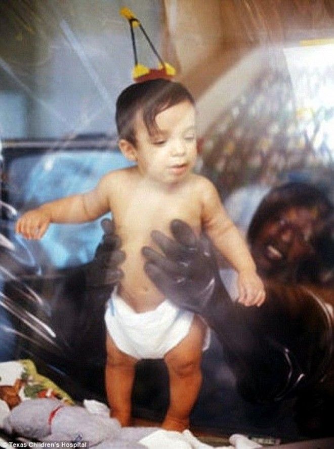 Дэвид Веттер мальчик который родился без иммунитета Фото dailymailcouk