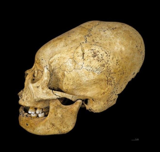 Модифицированный череп культуры протоНаска Перу 200100 гг до нэ Фото commonswikimediaorg