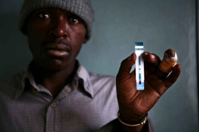 Смертность от СПИДа в Кении пугающе высока