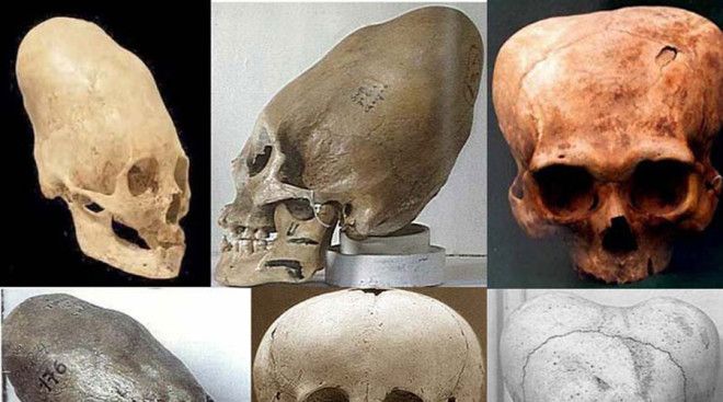 Удлиненные черепа При раскопках в регионе Лапаил археологи обнаружили удлиненные черепа Открытие взбудоражило весь научный мир необычная форма останков это еще цветочки ведь ученые считали что человек никогда не был в Антарктиде прежде